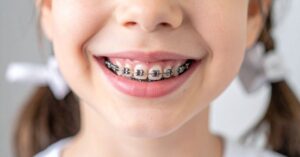 Close-up of a smiling child with braces, highlighting Invisalign vs braces options.
