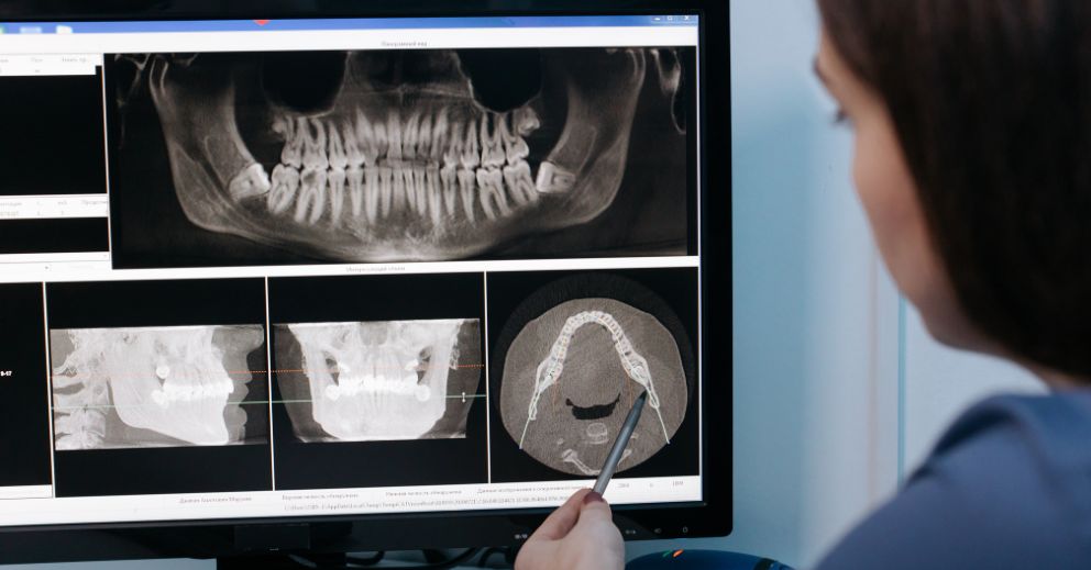 Person examining dental X-rays and scans of dental implants on a computer monitor.