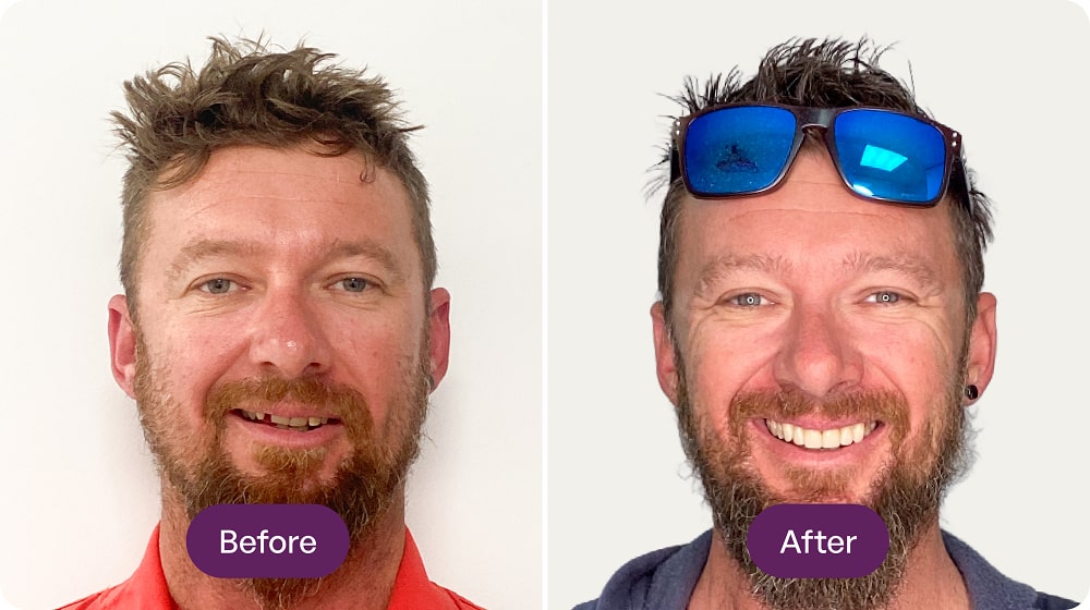 Man's before and after haircut transformation.